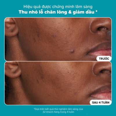 Dung dịch loại bỏ tế bào chết Skin Perfecting 2% BHA Liquid Exfoliant
