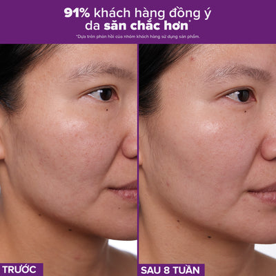 Tinh chất làm mờ nám và nếp nhăn Clinical 1% Retinol Treatment