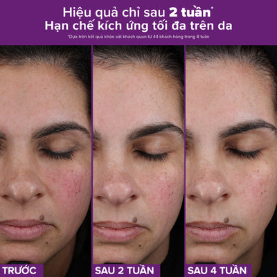 Tinh chất Retinaldehyde ngăn ngừa các dấu hiệu lão hóa và hỗ trợ giảm mụn PRO Retinaldehyde Treatment