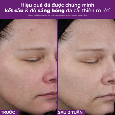 Tinh chất Retinaldehyde ngăn ngừa các dấu hiệu lão hóa và hỗ trợ giảm mụn PRO Retinaldehyde Treatment