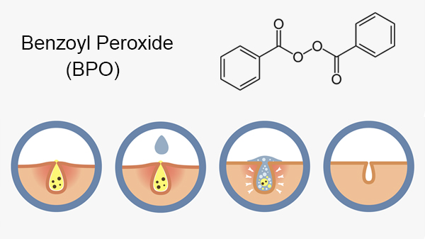 Benzoyl Peroxide kết hợp với gì