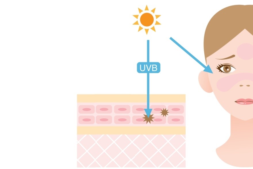 Tia UVA và UVB là các tia xuất hiện trong ánh nắng mặt trời, gây hại cho da ảnh 3