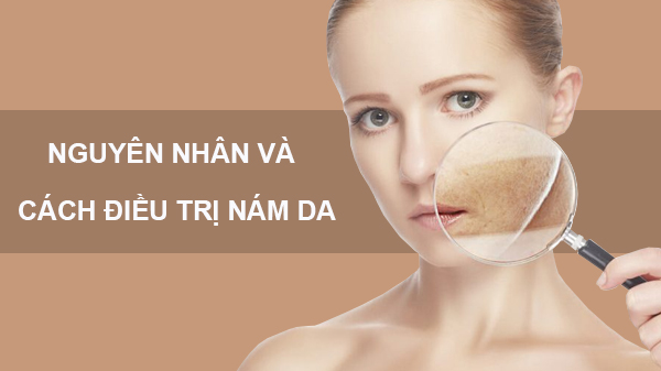 Có những cách tự nhiên nào để làm giảm nám da mặt?
