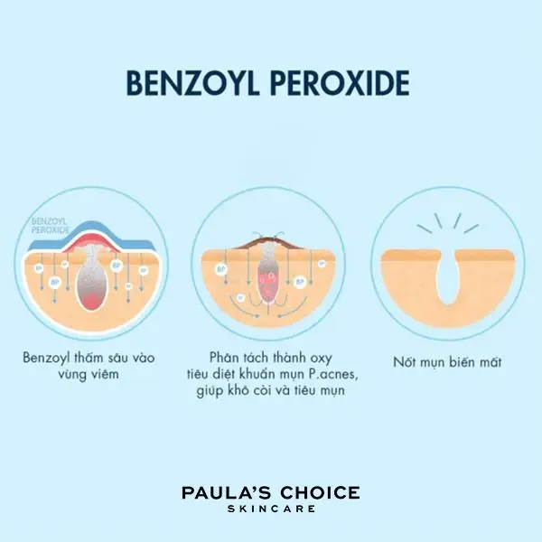 Benzoyl peroxide la gi 2